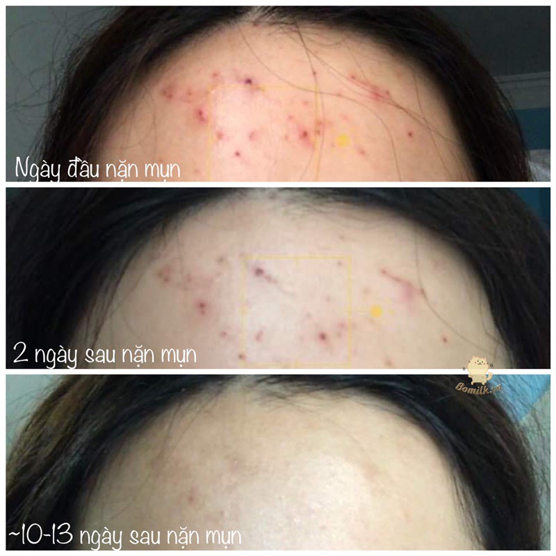 Serum Teana D6 Panthenol - Phục hồi, mờ thâm