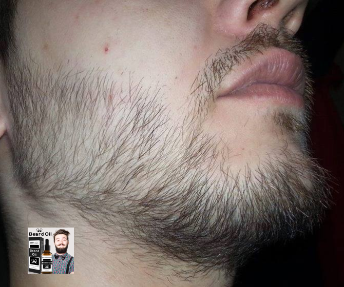 Mọc Râu Mọc Tóc Mọc Lông Mày Beard Oil