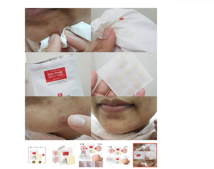 Miếng Dán Mụn COSRX Hàn Quốc