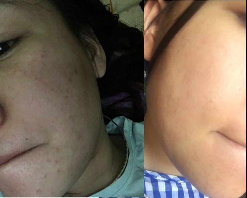 Kem Nám Dr. Skin Chính Hãng