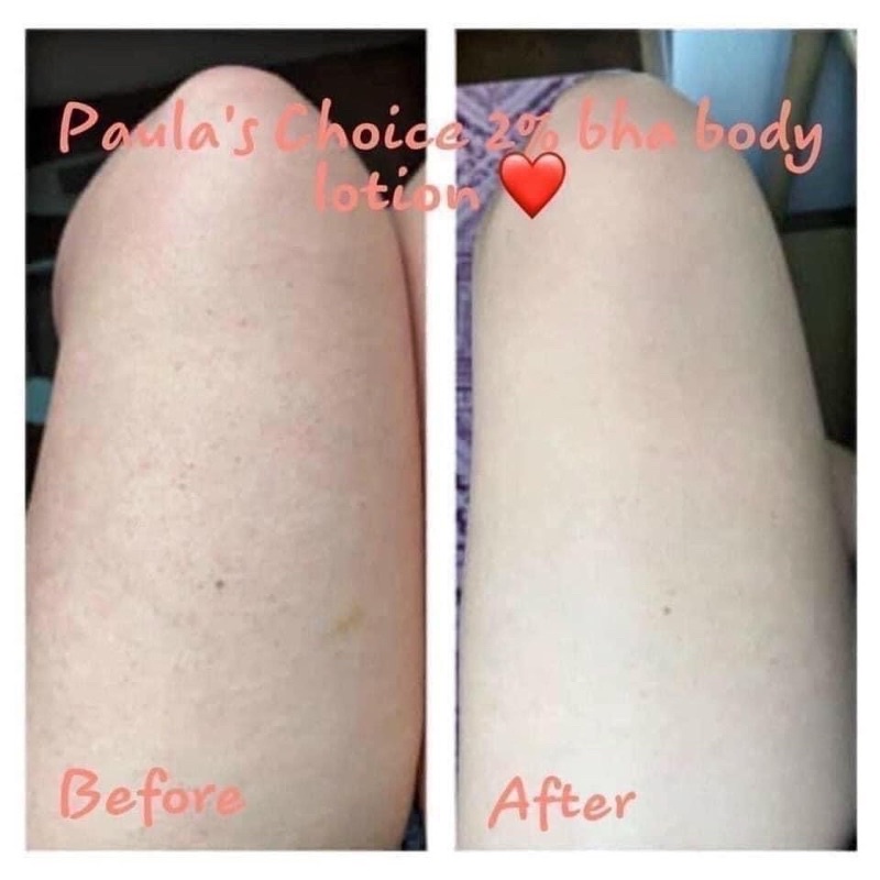 KEM DƯỠNG BHA BODY 2% PAULACHOI