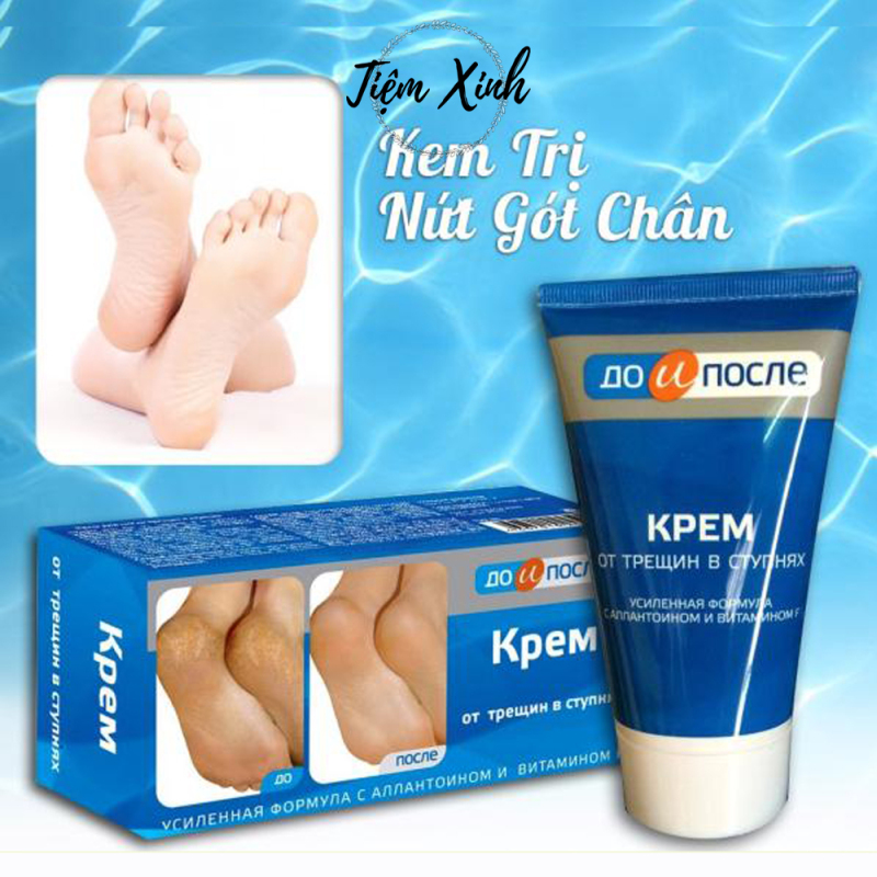 Kem trị nứt gót chân Kpem Apteka của Nga 50ml kem dưỡng da chân, nẻ gót chân mềm mịn cao cấp
