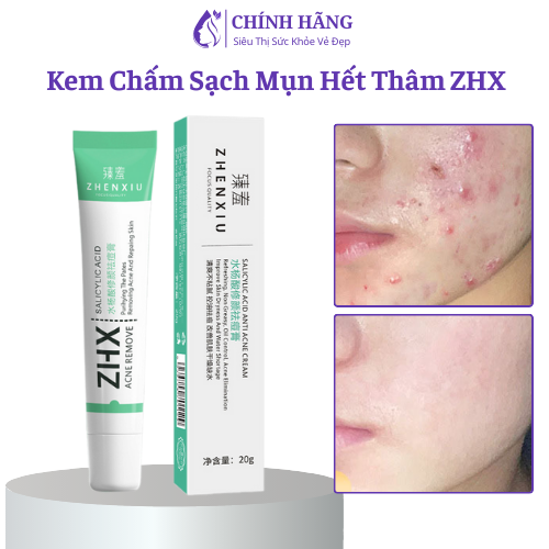 Kem đánh bay Mụn mẫu mới ZHENXIU Hết Mụn, Giảm Sưng Tấy, Mờ Thâm Mụn Hiệu Quả 20g