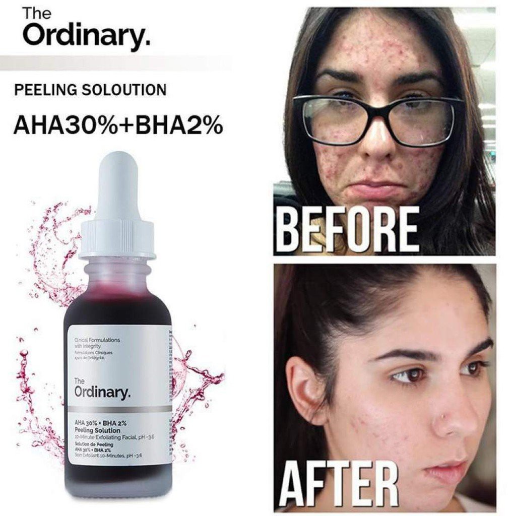 Serum The Ordinary Peel Da AHA 30%+BHA 2% Peeling Solution 30ml