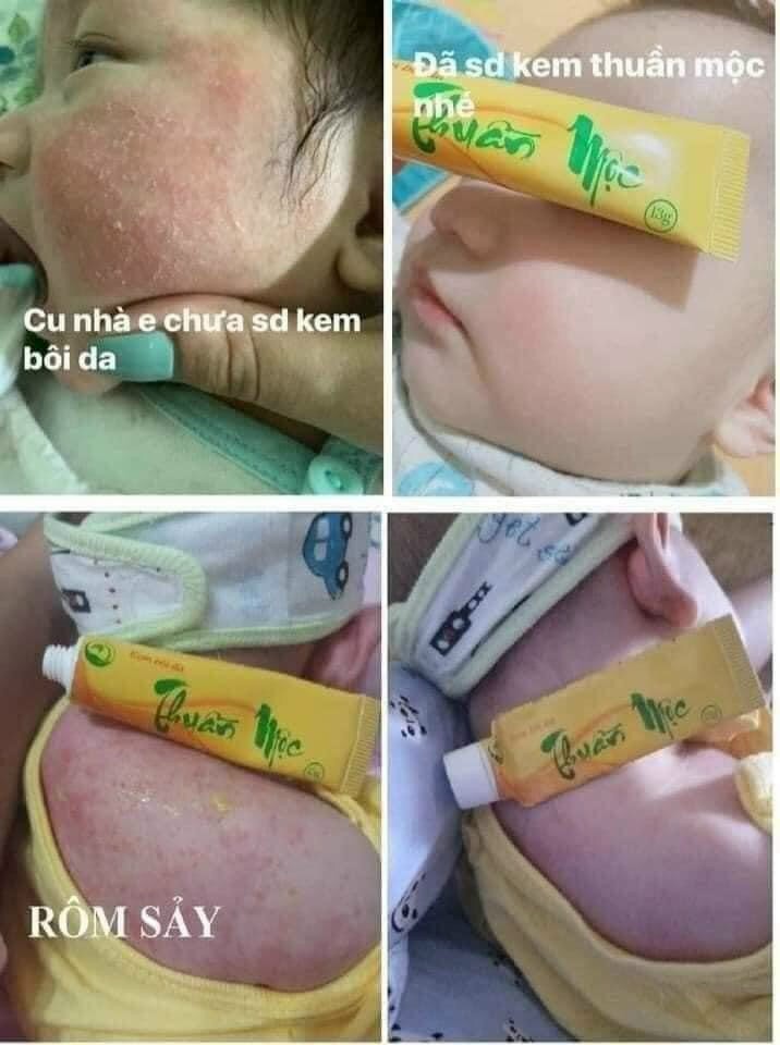 Kem Bôi Da Thuần Mộc Thanh Mộc Hương