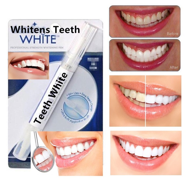 Sét 5 Bút Tẩy Trắng Răng Dazzling White Mỹ