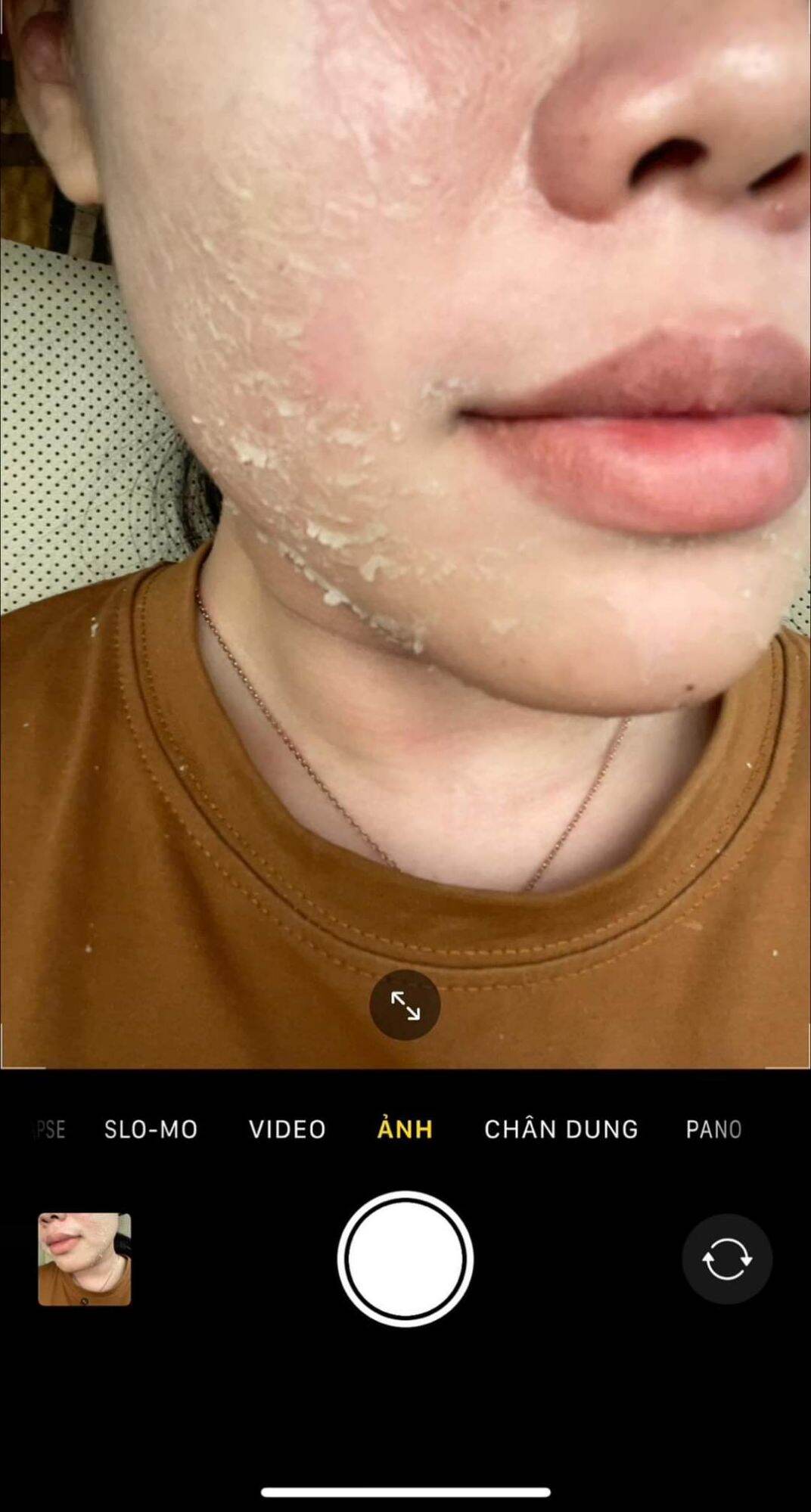 Peel Tảo Sâm Bóc Tách Nám Meea