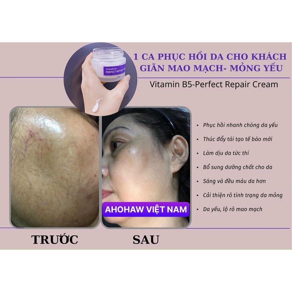Kem Dưỡng Siêu Phục Hồi Da  Ahohaw