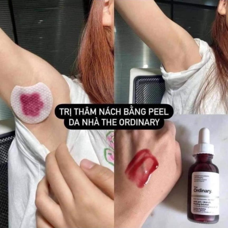 Tinh Chất Peel da The Ordinary AHA 30%+BHA 2% Peeling Solution 30ml
