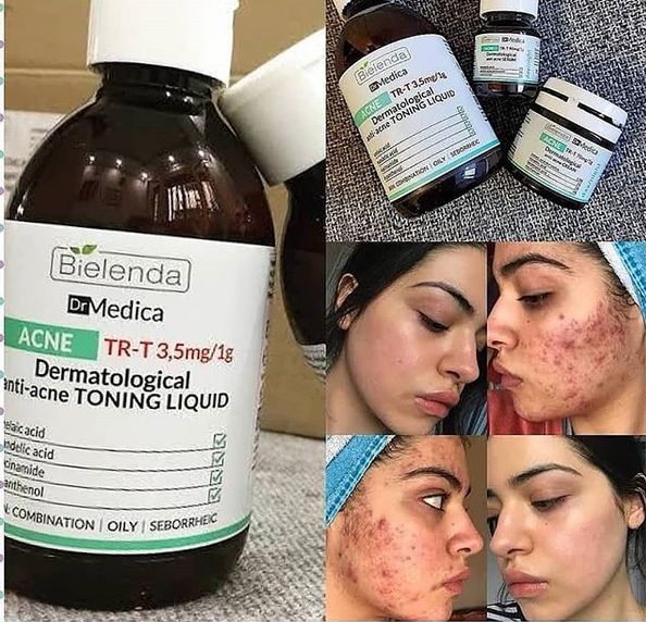 Sữa rửa mặt Dr Medica Bielenda da mụn