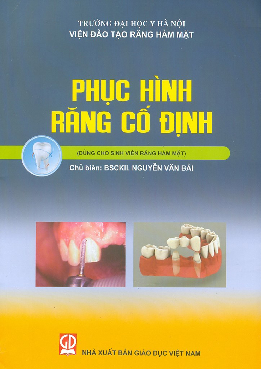 Phục Hình Răng Cố Định (Dùng Cho Sinh Viên Răng Hàm Mặt)
