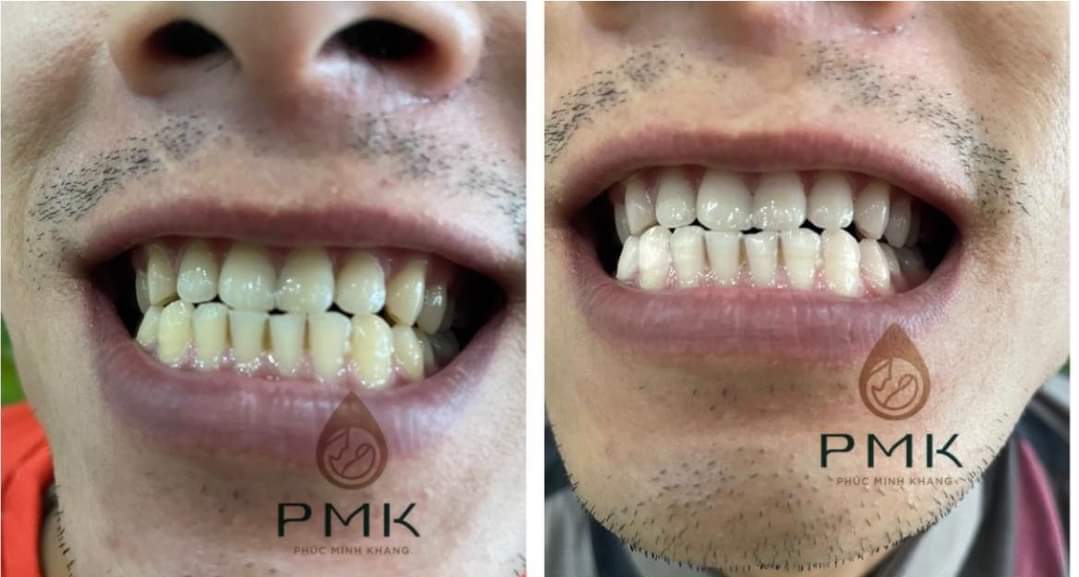 Thảo dược răng miệng Minh Khang