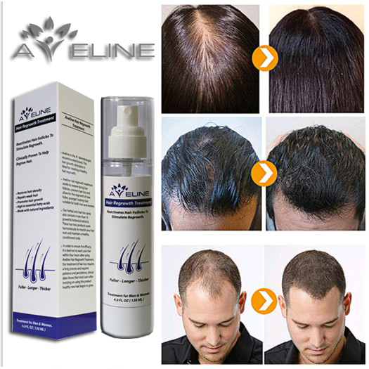Sản phẩm hỗ trợ mọc tóc Aveline - Mỹ