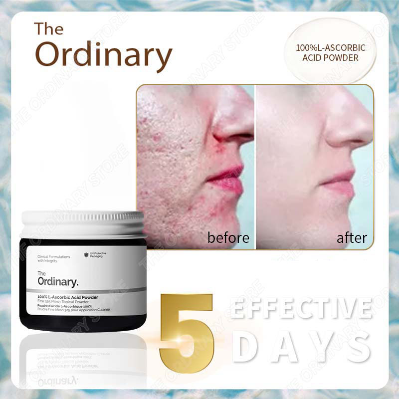 The Ordinary Bột Vitamin C 100% L-Ascorbic Acid Powder kem body siêu trắng nhanh toàn thân chống oxy hóa dưỡng trắng da