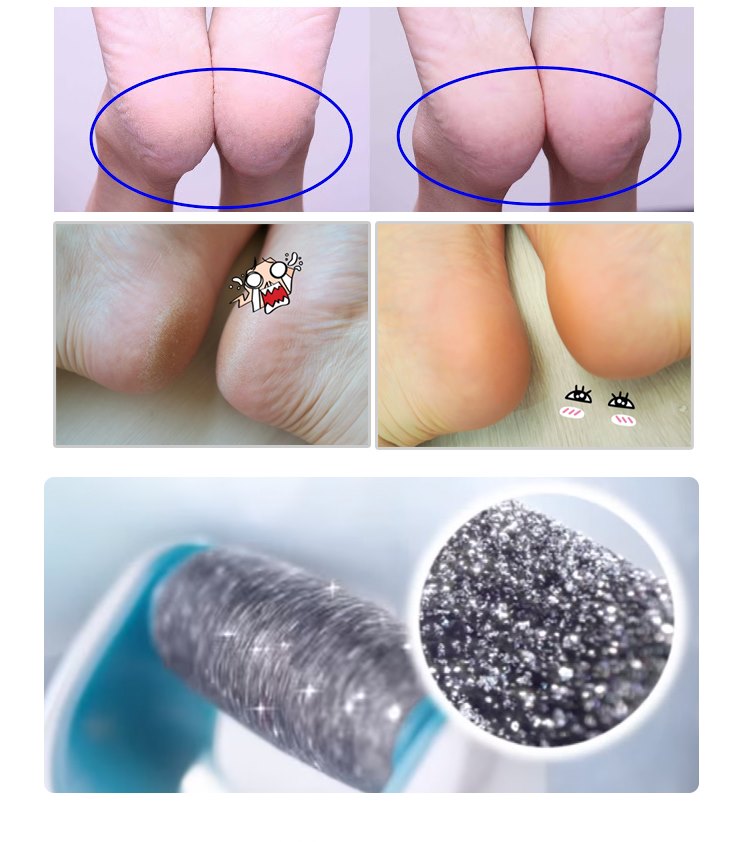 MÁY CHÀ GÓT CHÂN CHUYÊN DỤNG