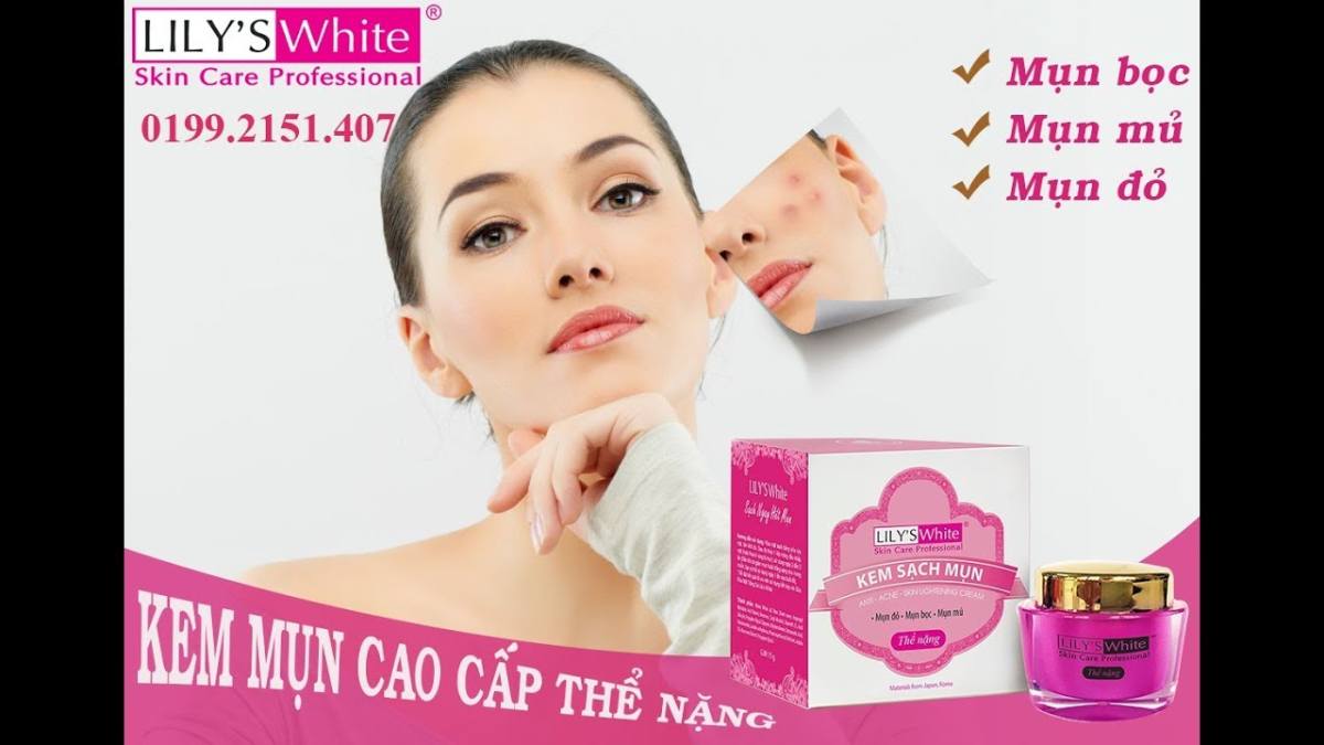 Kem Mụn LILY'S WHITE thể nặng ( mụn bọc,mụn mủ )16g
