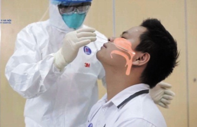 [100 que] Que lấy dịch tỵ hầu ( dịch mũi )