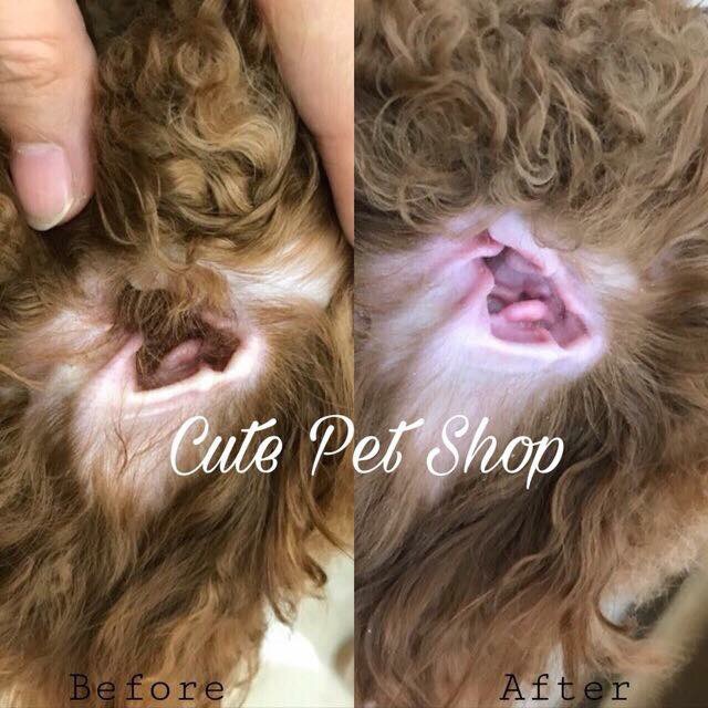 Combo kẹp nhổ lông tai + bột nhổ lông tai✨
