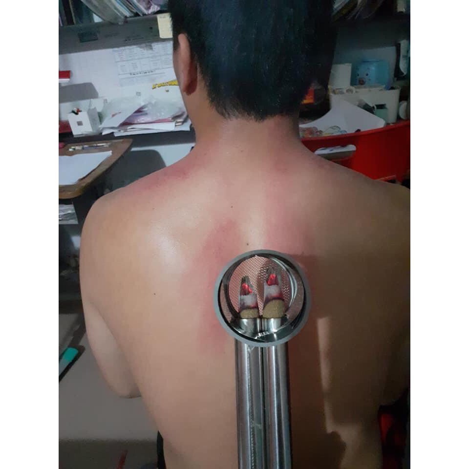Ống Hơ Ngải Cứu Đôi Diện Chẩn