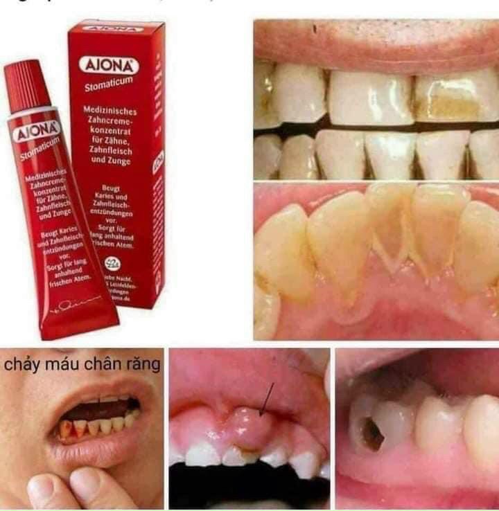 Kem đánh răng Ajona Đức