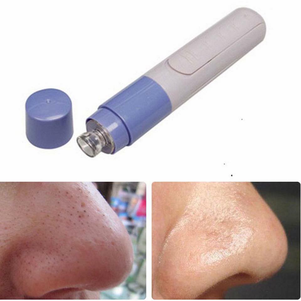 Máy Hút Mụn Dùng Pin Cầm Tay Spot Cleaner Giá Rẻ