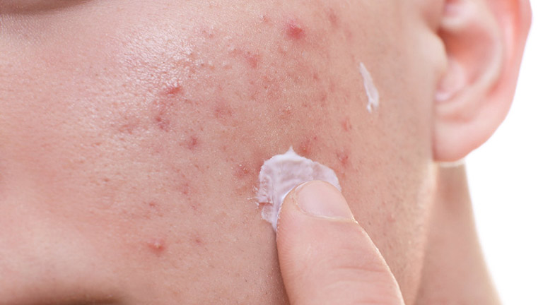 Kem Giảm Thâm mụn DERMAFORTE