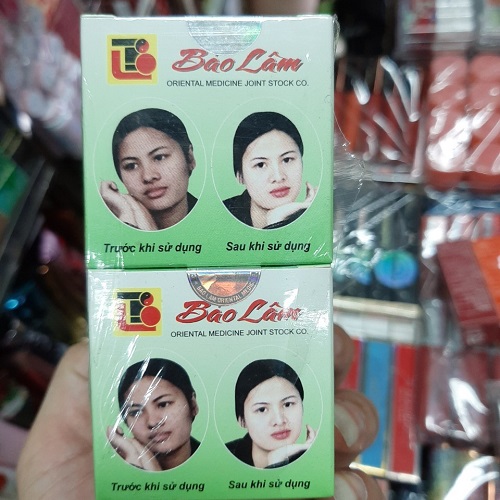 Kem trắng da chống nám - Bảo Lâm