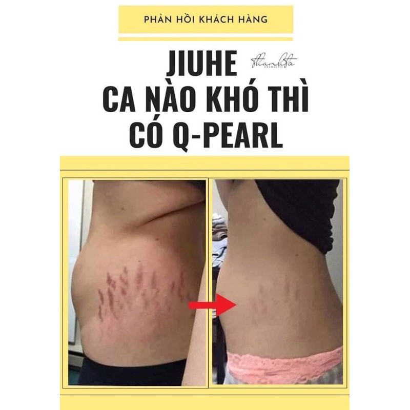 Sỉ jiuhe chính hãng mờ thâm nám sạm