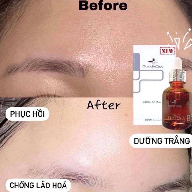 [NEW] SERUM B5 GOODNDOC HYDRA CHÍNH HÃNG