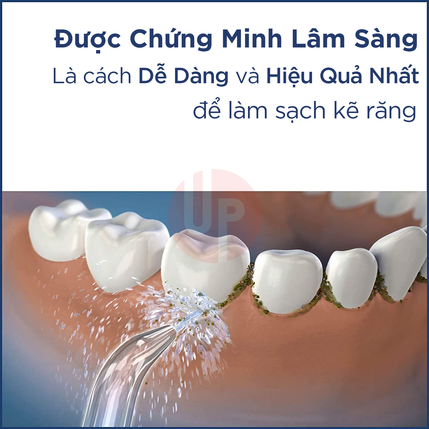 Máy tăm nước Waterpik WP-462 PLUS