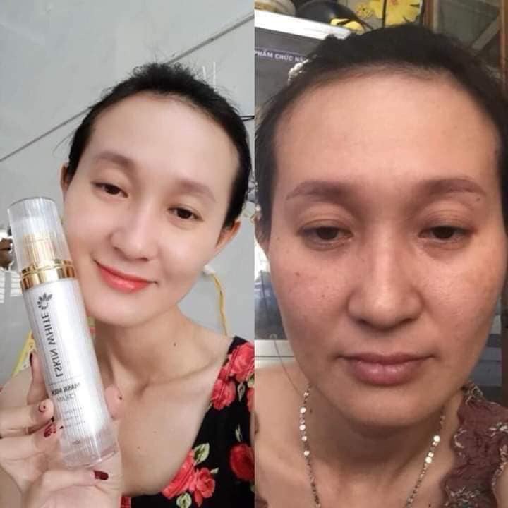 [HCM]Ủ Trắng Kén Tằm LSkin Đan Thy Group