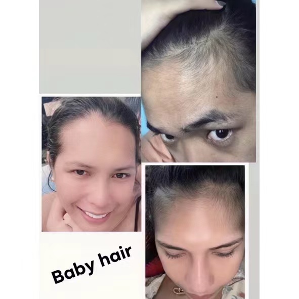 Minoxidil 15% (Bán chạy nhất) (Niêm phong) Sản xuất tại Thái Lan đích thực