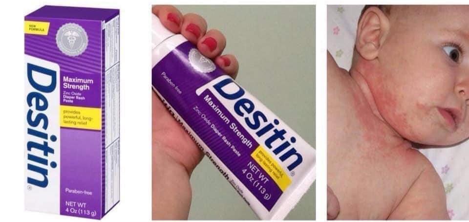 [HCM]KEM TRỊ HĂM DESITIN 113g màu tím