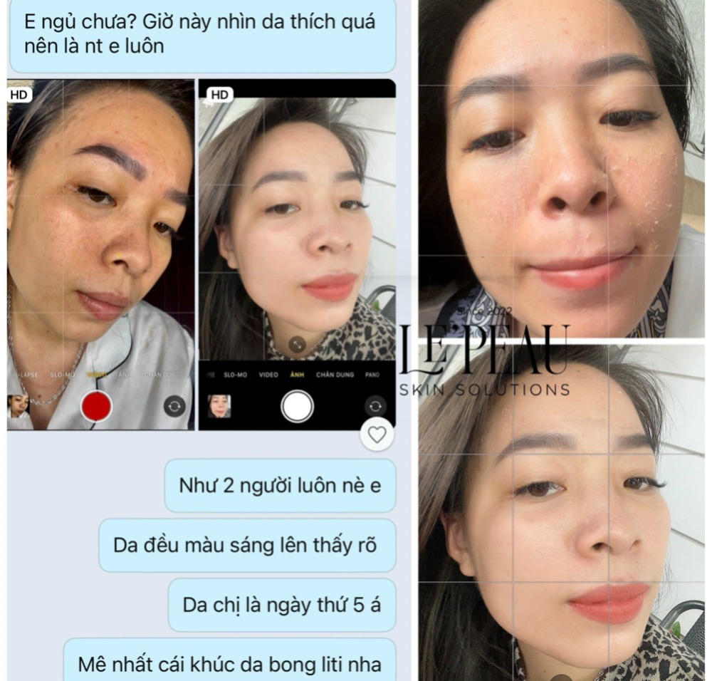 LE’PEAU - Peel da Vi Tảo Retinol [Lepeau tái tạo da sinh học, tặng kèm serum B5 phục hồi da]