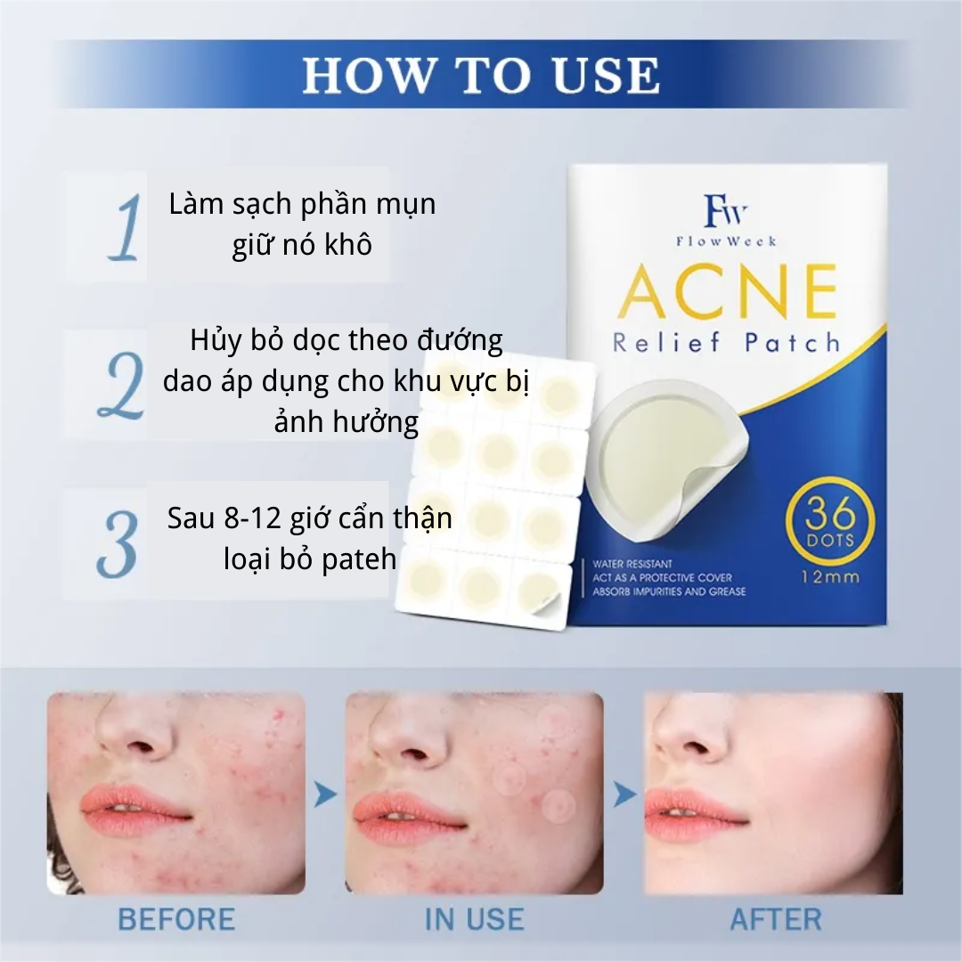 Flow Week Miếng dán trị mụn Miếng dán trị mụn Hydrocolloid Miếng dán trị mụn không thấm nước Miếng dán trị mụn Hydrocolloid Miếng dán trị mụn vô hình thoáng khí Miếng dán chống mụn trên mặt
