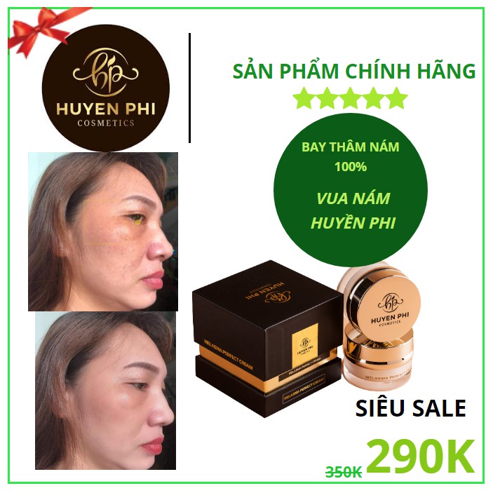 Kem Nám[Hàng Chính Hãng] Vua Nám Huyền Phi