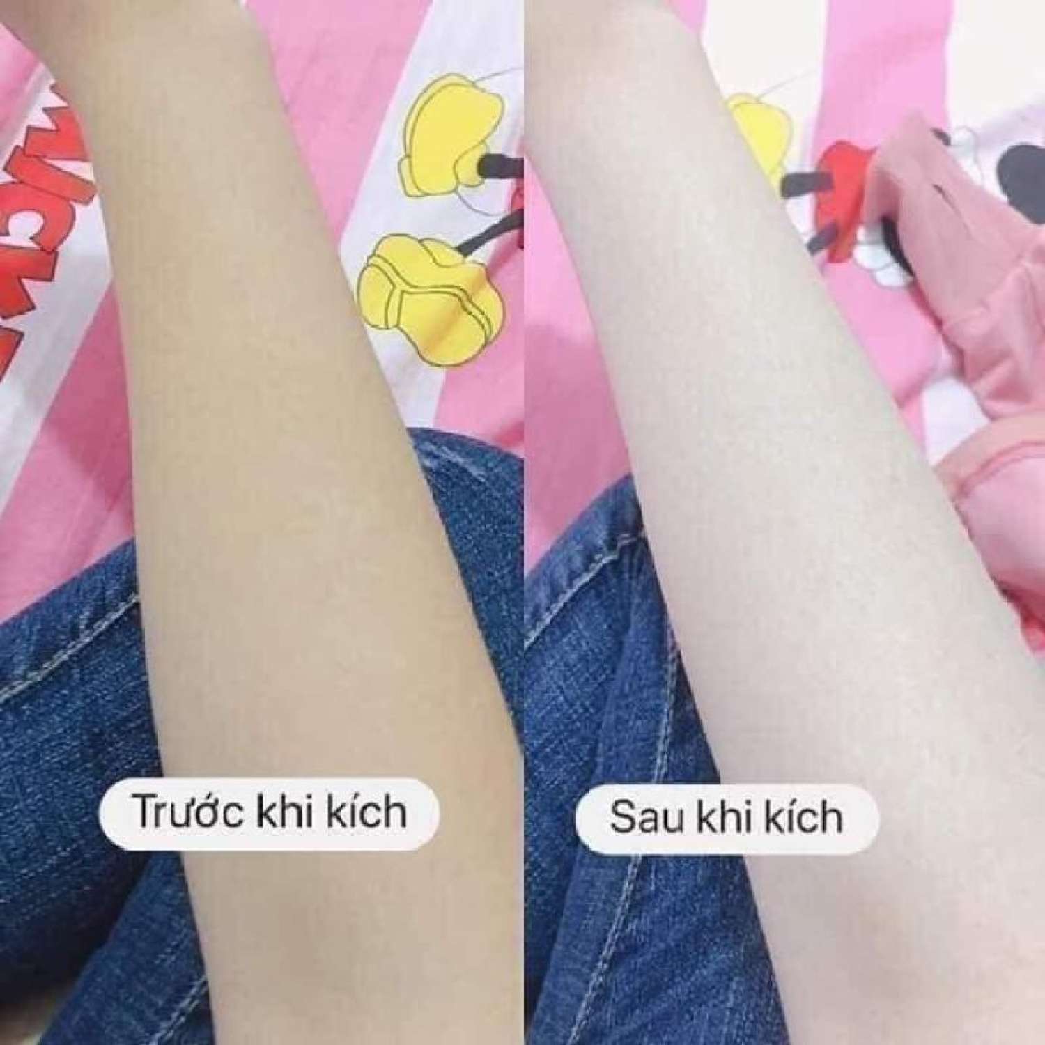 [HCM]Kích trắng Vitamin B10 - kem dưỡng body