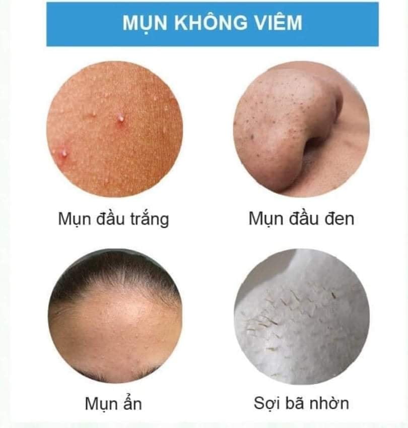 [HCM]Kem trj mụn Dr.Skin Acne hũ 15g