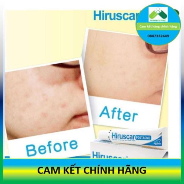 ! Gel làm mờ sẹo mụn và thâm mụn Hiruscar Post Acne [Hirusca, post acnes] !