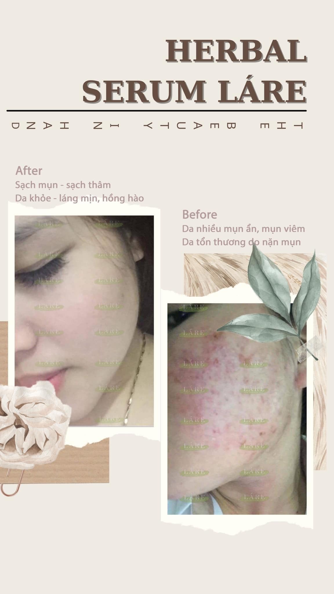 Combo 2 Serum Thảo Mộc Thanh Dược Lare 80ml
