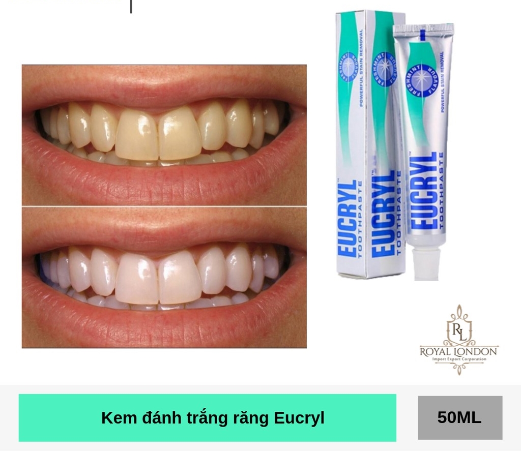 Kem Đánh Răng Bạc Hà Tẩy Trắng Eucryl Toothpaste 62g