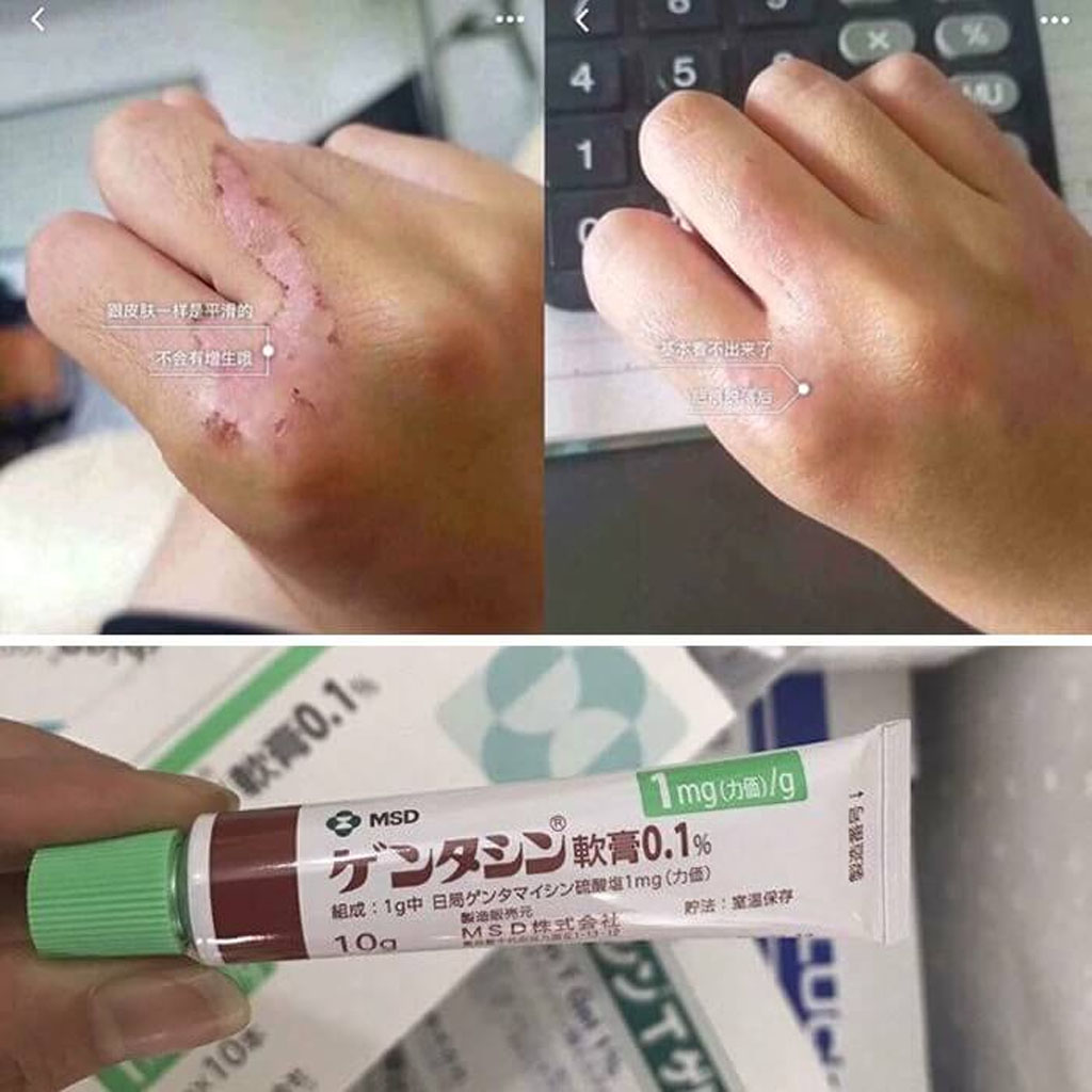 Kem Làm Mờ Sẹo Gentacin Ointment 10g