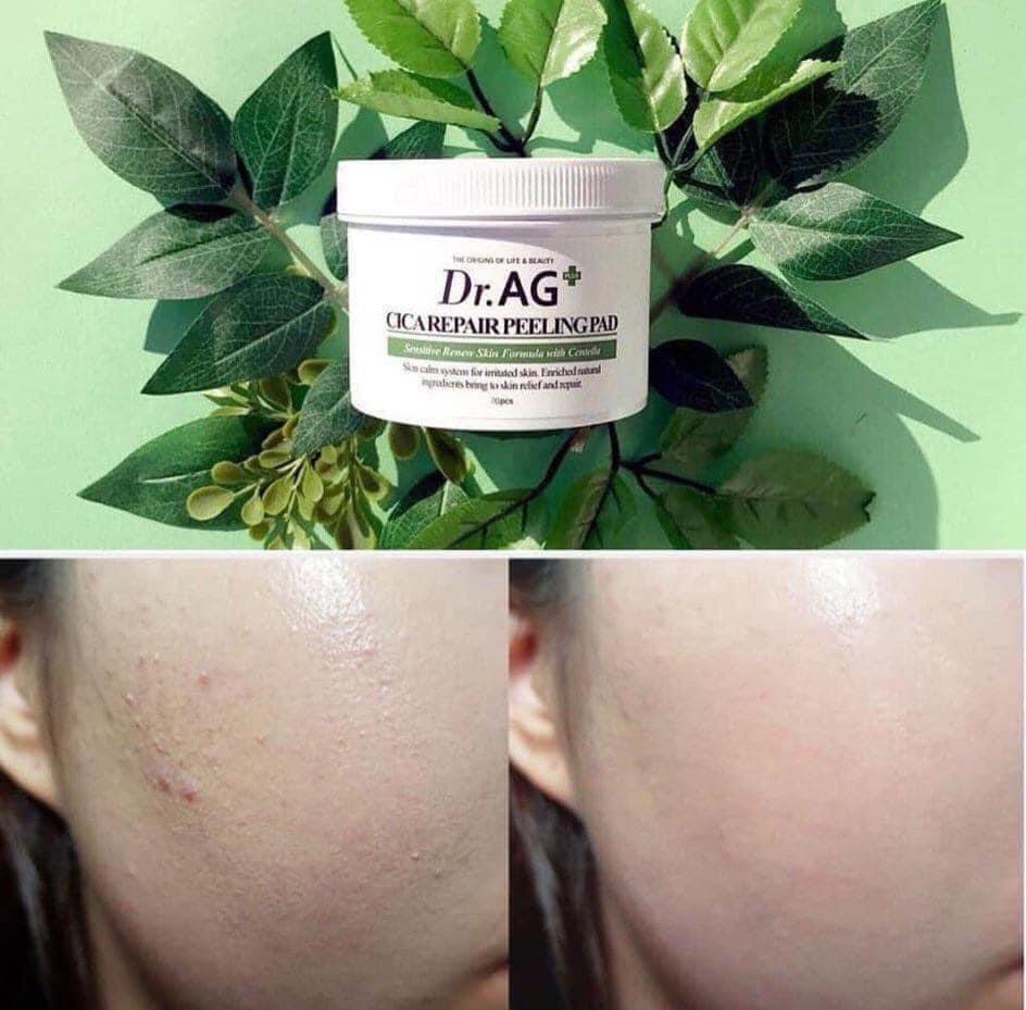 Miếng tẩy tế bào chết hàng ngày Dr.AG+ Peeling Pad