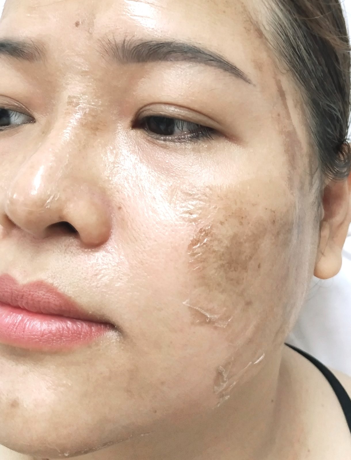 Lột BEZY Tái Tạo Da Mặt Hết Nám Thâm Sạm
