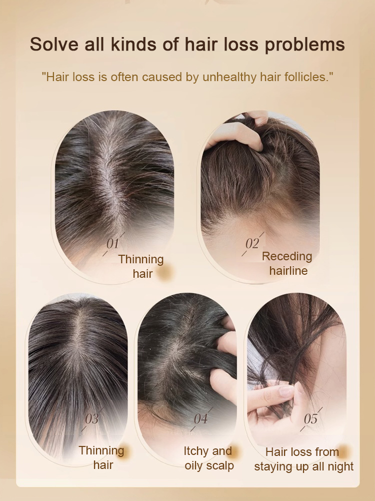 Anti-hair loss shampoo Ginger plant extract shampoo