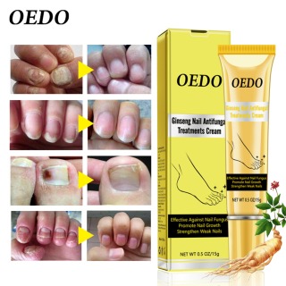 OEDO Kem chống nấm móng tay giúp tẩy lớp biểu bì dầu làm trắng và giúp móng phát triển khỏe mạnh hiệu quả nhanh chón không gây kích ứng - intl thumbnail