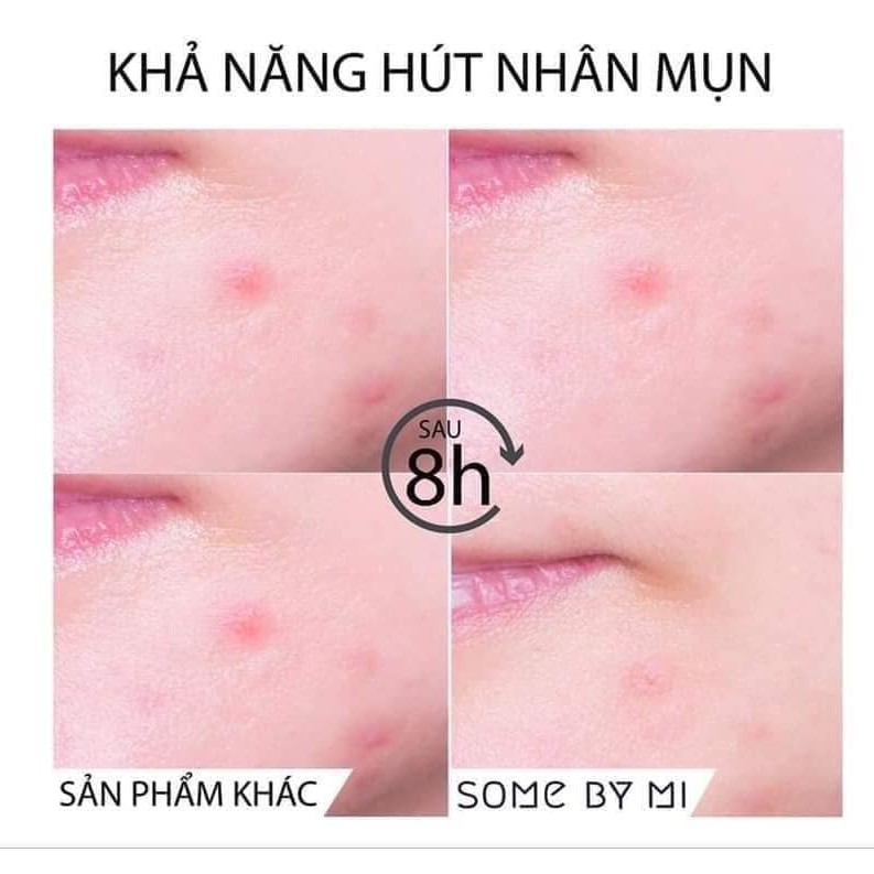 Miếng Dán Mụn Some By Mi Xẹp Mụn Cấp Tốc - Some By Mi Clear Spot Patch (Set 18 miếng)