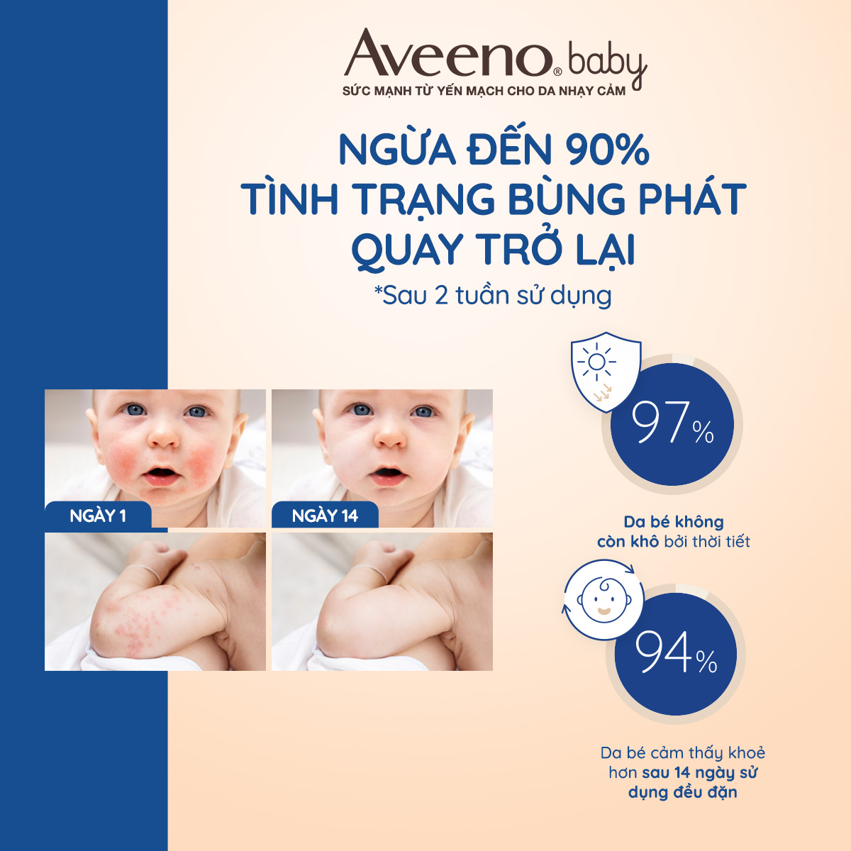 GIFT_Combo 2 Kem dưỡng ẩm cho bé Aveeno Baby Soothing Relief Moisture Cream 14g