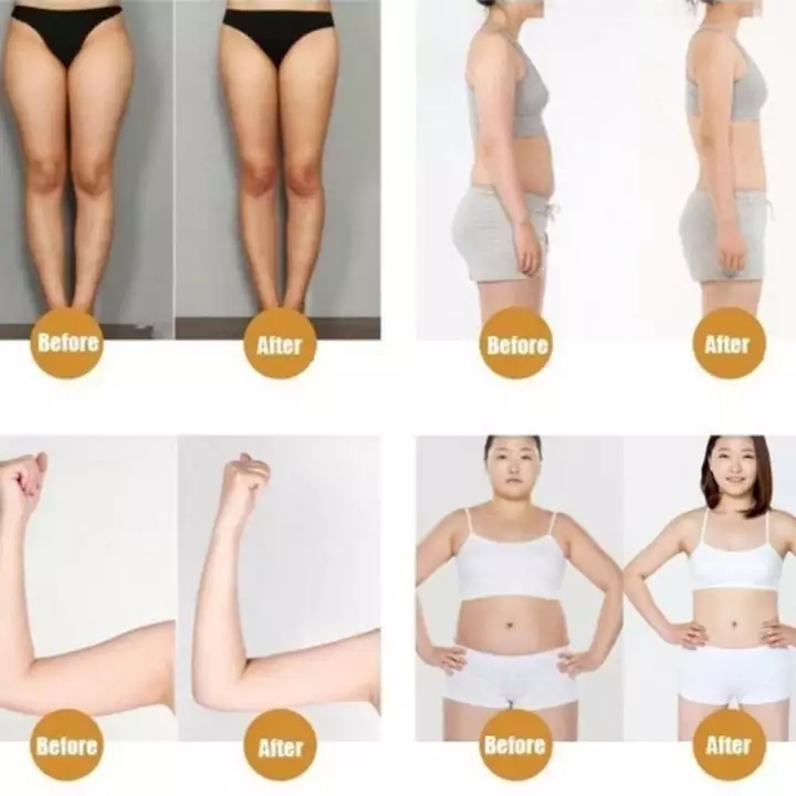 [HCM]10 Patch Dán Giảm Cân Dán Rốn Tan Mỡ Trung Y Slimming Patch