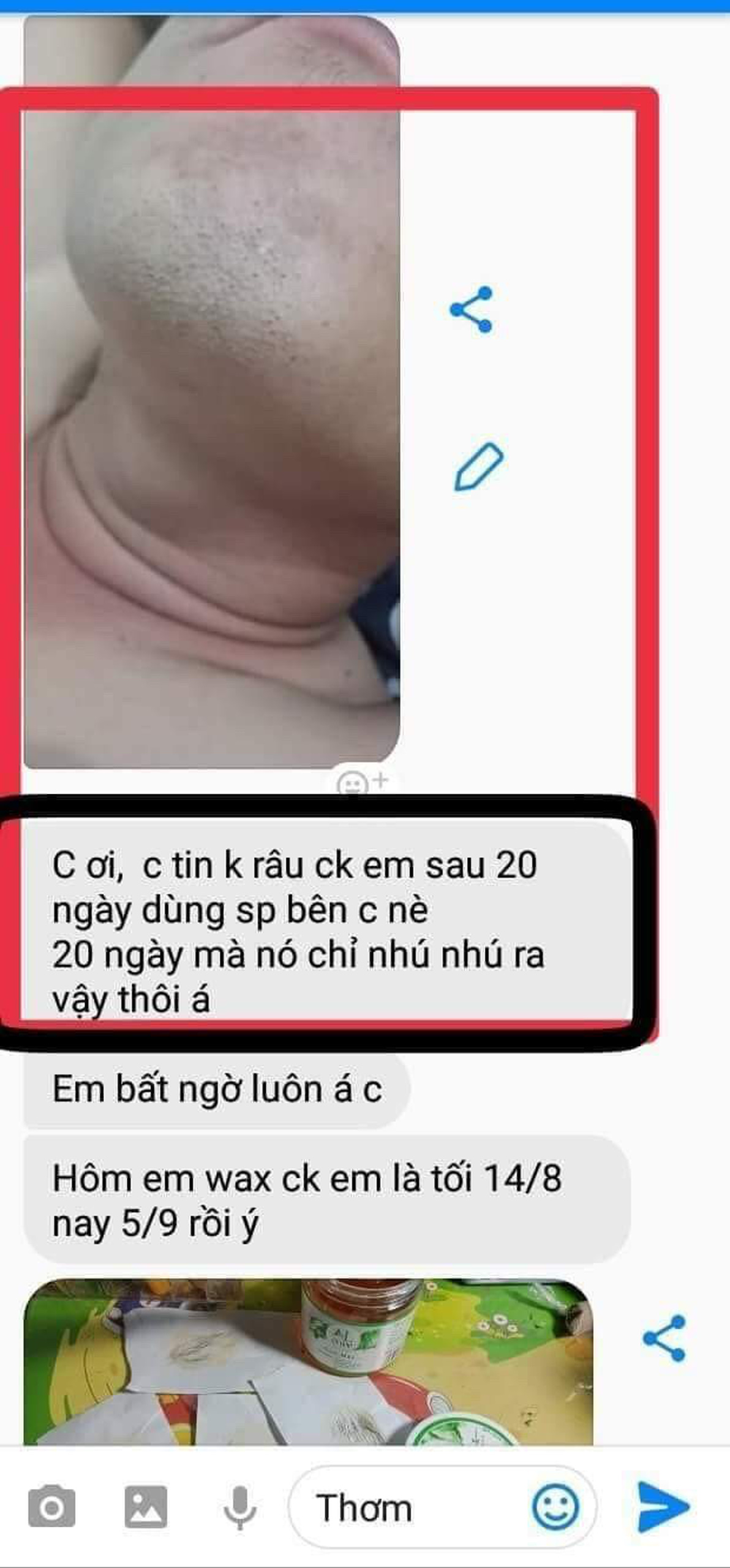 Combo triệt lông từ wax lông và mỡ trăn An Lành (tặng kèm giấy)